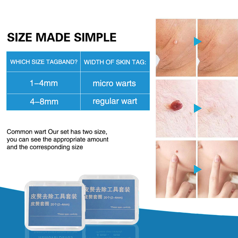 20 Stück/Box Flesh Nevus Entfe – Men Accessories Kit Bewertung und Preis